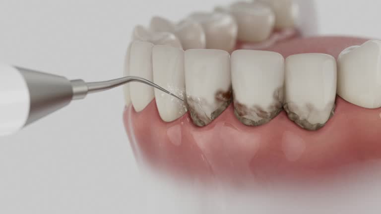 Reliable Teeth Cleaning And Checkup contractor in Appomattox County County, VA by Dentist Open Now